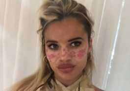 Essayez un soin du visage DIY vu sur TikTok et finissez à l'hôpital