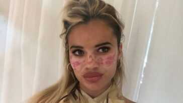 Essayez un soin du visage DIY vu sur TikTok et finissez à l'hôpital 9 Essayez un soin du visage DIY vu sur TikTok et finissez à l'hôpital