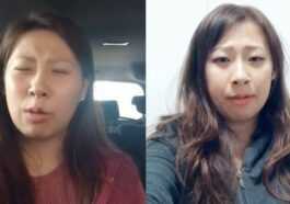 Après une opération, il se réveille avec un accent irlandais: l'histoire est virale sur TikTok