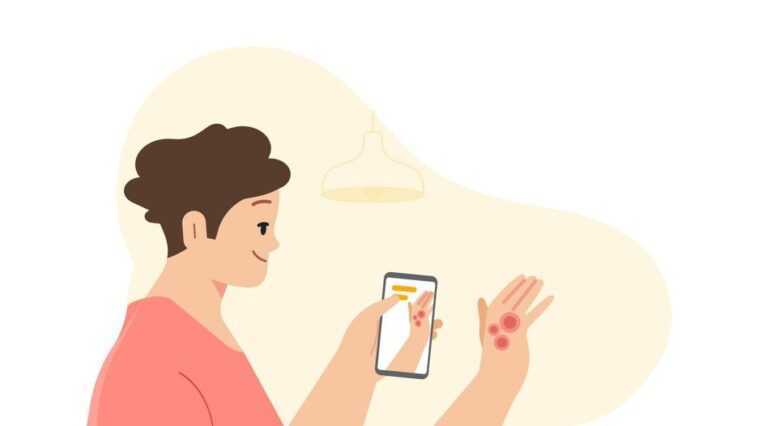 Cette application vous dira si vous avez un cancer de la peau 1 Cette application vous dira si vous avez un cancer de la peau