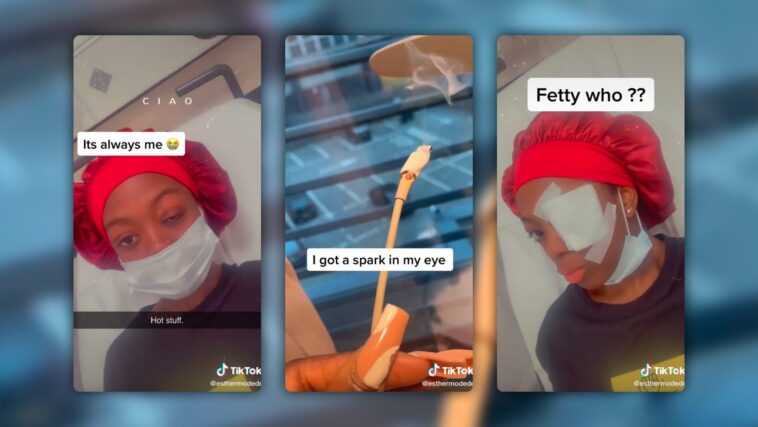 Le chargeur de l'iPhone endommagé explose, un jeune de 19 ans est aveuglé 1 Le chargeur de l'iPhone endommagé explose, un jeune de 19 ans est aveuglé
