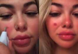 Essayez d'enlever une taupe avec une perceuse, puis publiez la vidéo du résultat sur TikTok