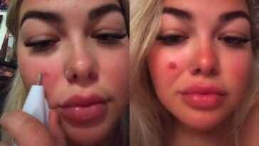 Essayez d'enlever une taupe avec une perceuse, puis publiez la vidéo du résultat sur TikTok 25 Essayez d'enlever une taupe avec une perceuse, puis publiez la vidéo du résultat sur TikTok