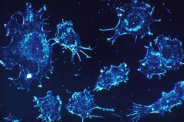 Pilule révolutionnaire contre le cancer du poumon approuvée 1 Pilule révolutionnaire contre le cancer du poumon approuvée