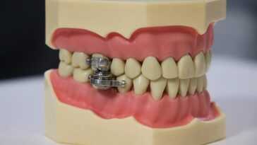 Struggling to lose weight? A new device that wires your jaw together could help