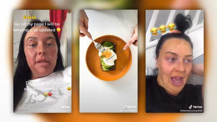 Essayez de cuisiner des œufs avec un truc vu sur TikTok mais ça lui brûle le visage 1 Essayez De Cuisiner Des œufs Avec Un Truc Vu Sur