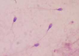 Un Contraceptif Révolutionnaire à Base D'anticorps Monoclonaux Immobilise Les Spermatozoïdes