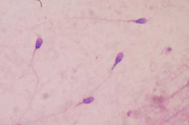 Un contraceptif révolutionnaire à base d'anticorps monoclonaux immobilise les spermatozoïdes 1 Un Contraceptif Révolutionnaire à Base D'anticorps Monoclonaux Immobilise Les Spermatozoïdes
