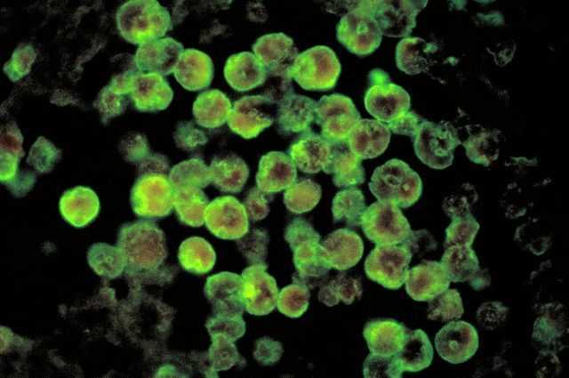 Deux enfants américains tués par une "amibe mangeuse de cerveau" : elle est mortelle dans 90 % des cas 1 Deux Enfants Américains Tués Par Une "amibe Mangeuse De Cerveau"
