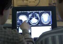La France Suspend Les études Sur Les Prions Après Qu'un