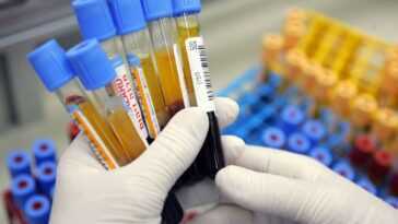 Un test sanguin peut détecter jusqu'à 50 types de cancer avant l'apparition des symptômes 14 Un Test Sanguin Peut Détecter Jusqu'à 50 Types De Cancer