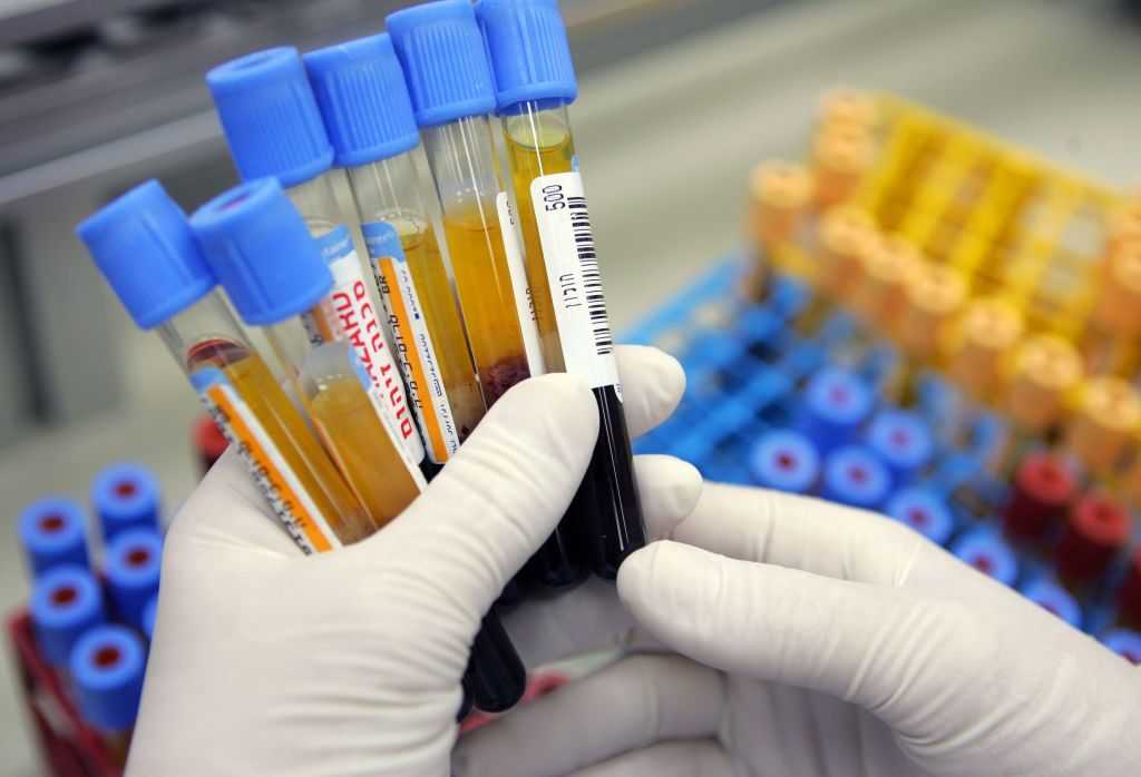 Un Test Sanguin Peut Détecter Jusqu'à 50 Types De Cancer