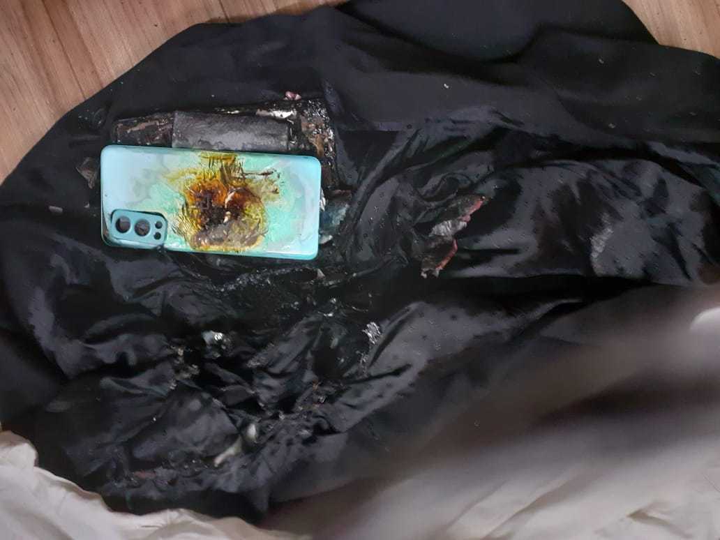 1631457737 537 OnePlus Nord 2 5G explose dans la poche dun avocat