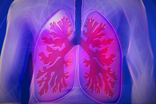 Découverte de la cause du cancer du poumon chez les non-fumeurs 1 Découverte De La Cause Du Cancer Du Poumon Chez Les