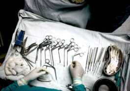 Une Femme A Reçu La Première Transplantation Cardiaque Artificielle Totale