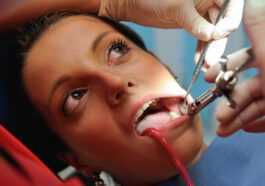 Maintenant, Nous Savons Pourquoi Les Dents De Sagesse Mettent Si