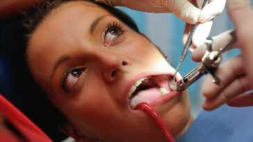 Maintenant, Nous Savons Pourquoi Les Dents De Sagesse Mettent Si