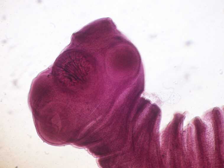 Un homme a découvert qu'il avait un ténia qui vivait dans son cerveau depuis des décennies 1 Un Homme A Découvert Qu'il Avait Un Ténia Qui Vivait