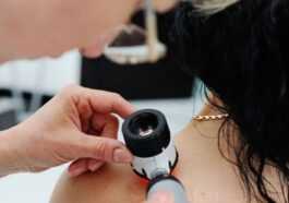Comment prévenir le basaliome ou le carcinome basocellulaire, le cancer de la peau le plus courant 21 Comment Prévenir Le Basaliome Ou Le Carcinome Basocellulaire, Le Cancer