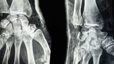 Un Chirurgien Français A Tenté De Vendre La Radiographie D'une