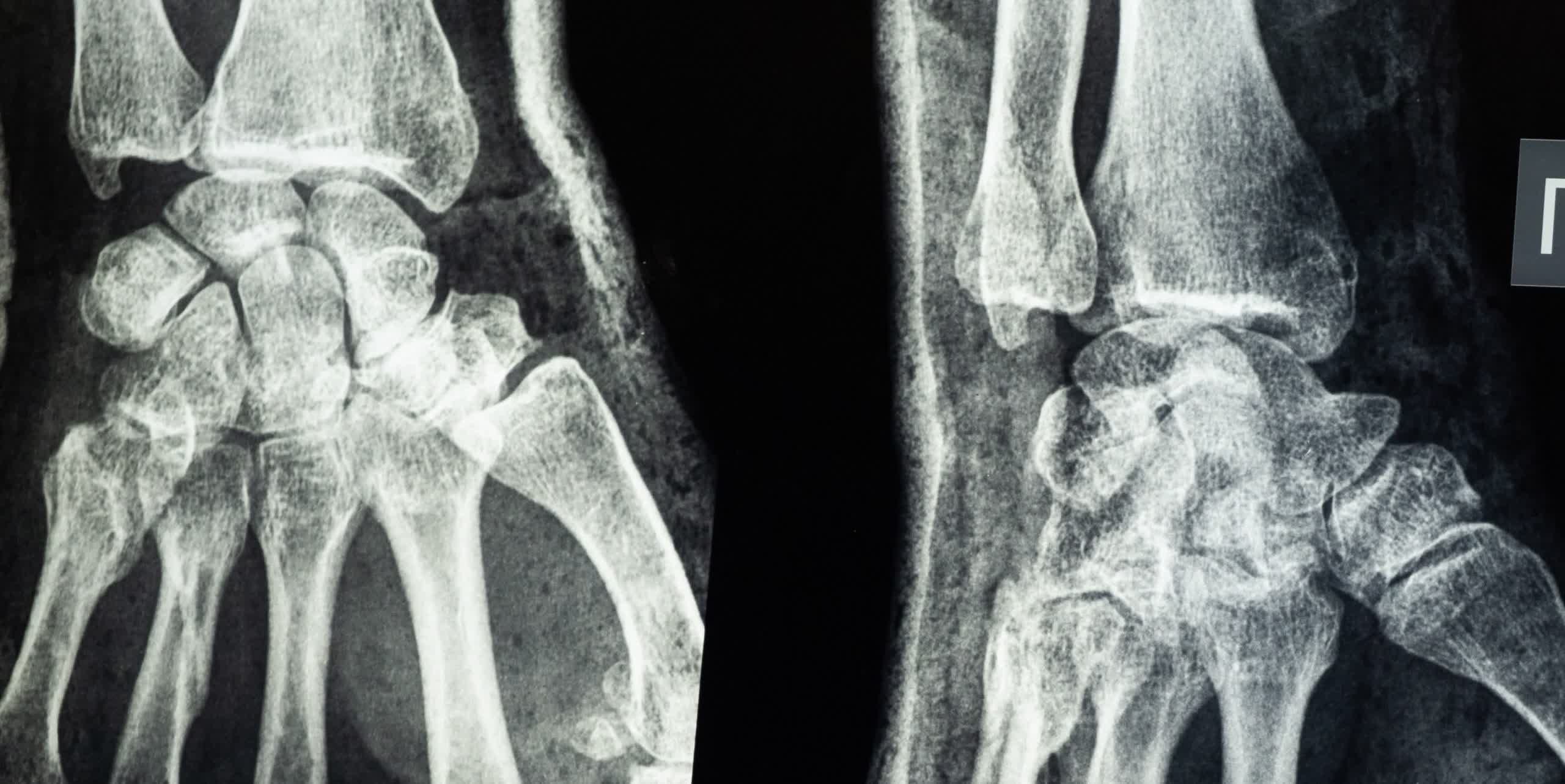 Un Chirurgien Français A Tenté De Vendre La Radiographie D'une