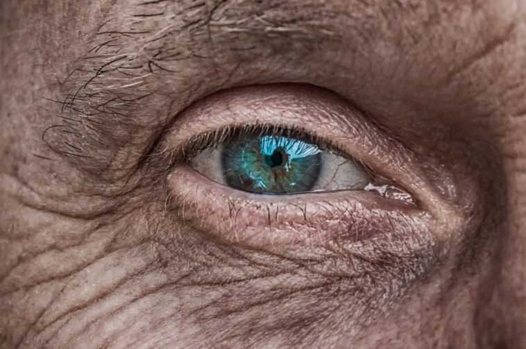 Un homme n'a pas pu fermer les yeux pendant 3 ans après une chirurgie plastique 1 Un Homme N'a Pas Pu Fermer Les Yeux Pendant 3