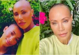 Jada Pinkett Smith Et L'alopécie, Quelle Est La Maladie Qui