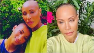 Jada Pinkett Smith et l'alopécie, quelle est la maladie qui lui a fait perdre ses cheveux 11 Jada Pinkett Smith Et L'alopécie, Quelle Est La Maladie Qui