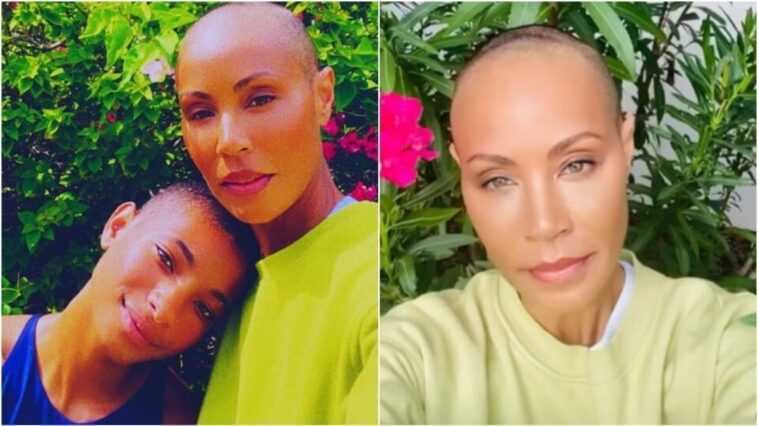 Jada Pinkett Smith et l'alopécie, quelle est la maladie qui lui a fait perdre ses cheveux 1 Jada Pinkett Smith Et L'alopécie, Quelle Est La Maladie Qui