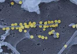 Un Autre Virus Vient D'asie, Provoquant Une Fièvre Hémorragique Qui