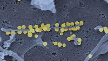 Un autre virus vient d'Asie, provoquant une fièvre hémorragique qui peut être mortelle 17 Un Autre Virus Vient D'asie, Provoquant Une Fièvre Hémorragique Qui