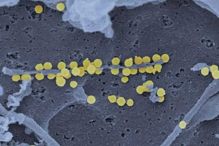 Un autre virus vient d'Asie, provoquant une fièvre hémorragique qui peut être mortelle 1 Un Autre Virus Vient D'asie, Provoquant Une Fièvre Hémorragique Qui