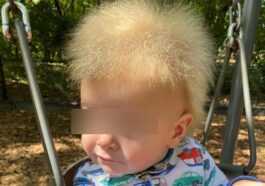 Un Enfant Atteint Du Syndrome Des Cheveux En Désordre Devient