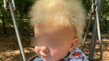 Un Enfant Atteint Du Syndrome Des Cheveux En Désordre Devient