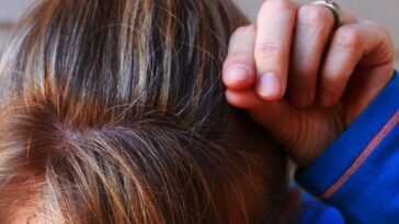 Vous tirez et vous arrachez les cheveux ? Vous pouvez avoir la trichotillomanie 6 Vous Tirez Et Vous Arrachez Les Cheveux ? Vous Pouvez