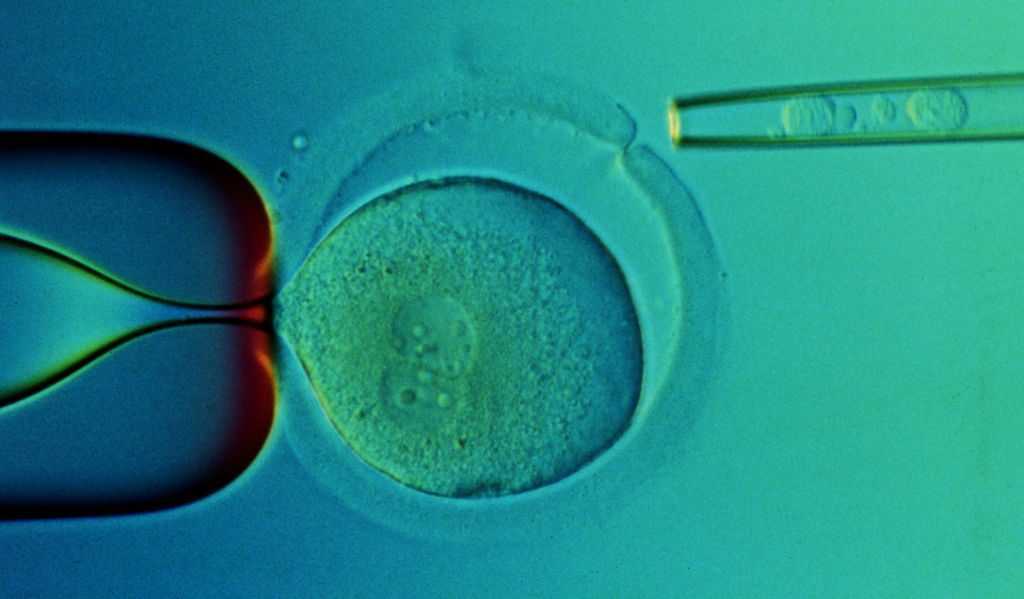 70% Des Femmes Qui Ont Congelé Des Ovules Avant L'âge