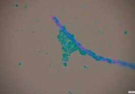 Ces Agents Pathogènes Peuvent Se Lier Aux Microplastiques Et Infecter