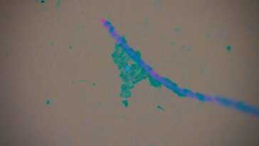 Ces agents pathogènes peuvent se lier aux microplastiques et infecter les animaux et les humains 7 Ces Agents Pathogènes Peuvent Se Lier Aux Microplastiques Et Infecter