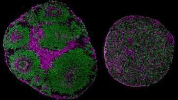 Une mutation génétique dans l'autisme peut être inversée grâce à la thérapie génique 29 Une Mutation Génétique Dans L'autisme Peut être Inversée Grâce à