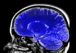 Une Thérapie Possible Pour Le Glioblastome, Le Cancer Du Cerveau