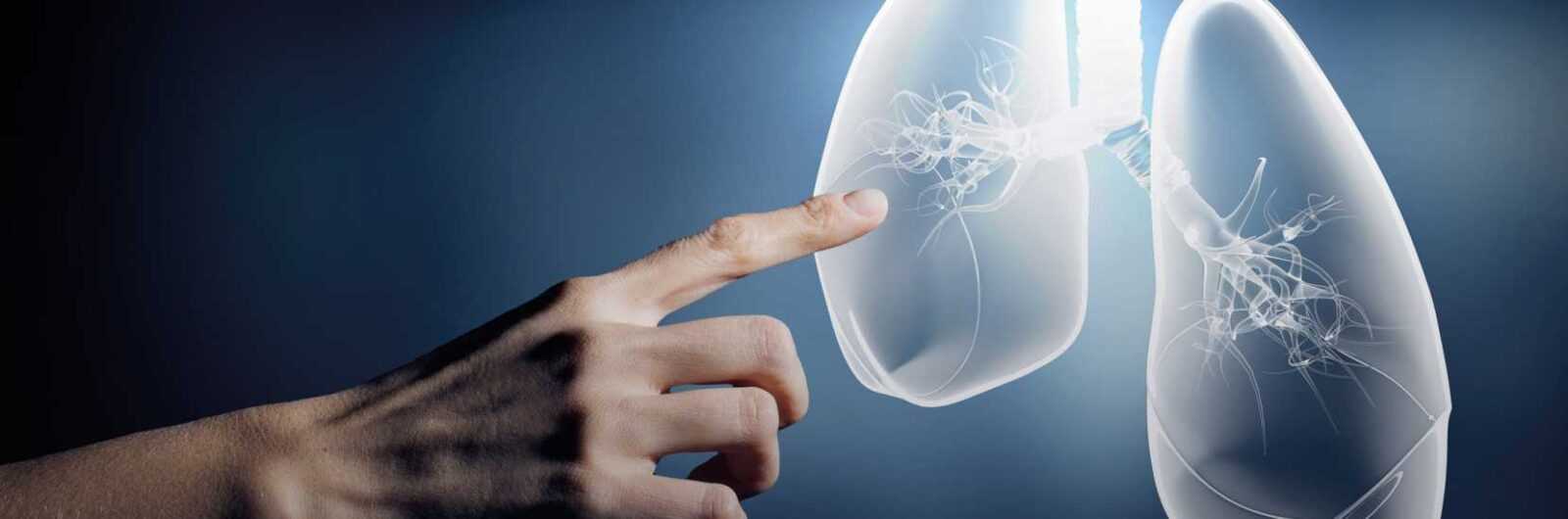 Pourquoi de nombreux fumeurs n'attrapent pas le cancer du poumon : un secret possible révélé 3 Cancer Poumon