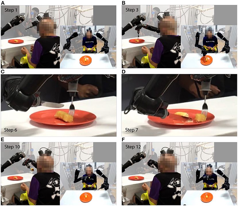 Deux bras robotiques contrôlés par la pensée permettent à un homme de recommencer à manger par lui-même 3 1656515406 327 Deux bras robotiques controles par la pensee permettent a un
