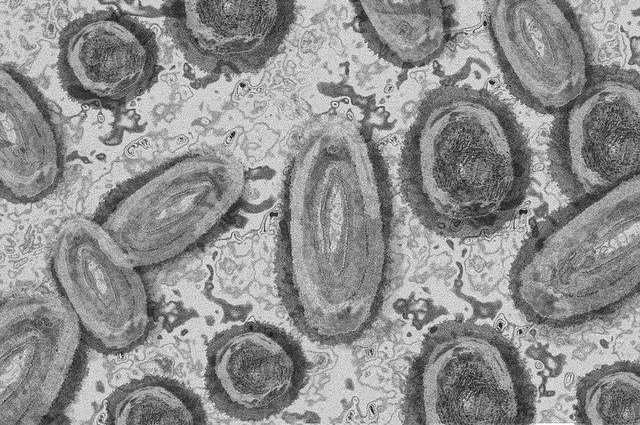 Comment la variole du singe s'est propagée : les premières études suggèrent une transmission sexuelle 1 Comment La Variole Du Singe S'est Propagée : Les Premières études