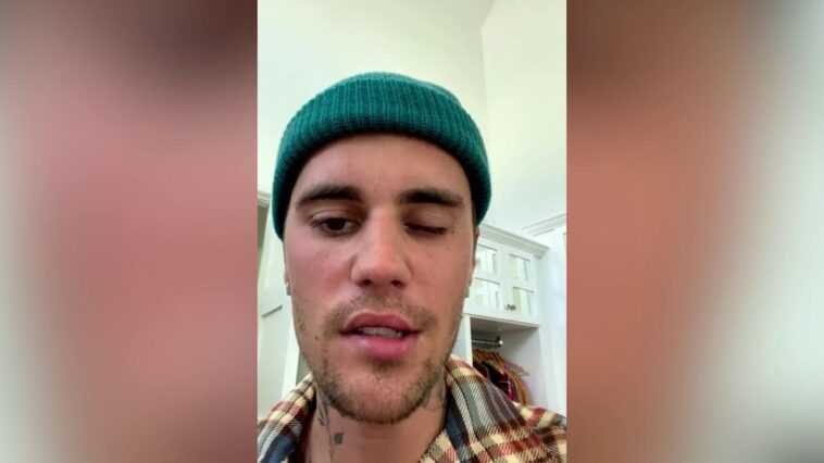 Qu'est-ce que le syndrome de Ramsay Hunt, la maladie qui a touché Justin Bieber 1 Qu'est Ce Que Le Syndrome De Ramsay Hunt, La Maladie Qui