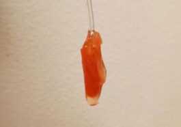 Ventricule Du Cœur Humain Cultivé En Laboratoire : Il Bat Et