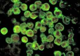 Nouveau Cas D'infection Par L'amibe Mangeuse De Cerveau : Qu'est Ce Que