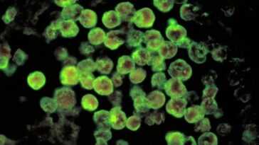 Nouveau cas d'infection par l'amibe mangeuse de cerveau : qu'est-ce que c'est, comment il se contracte et à quel point il est dangereux 1 Nouveau Cas D'infection Par L'amibe Mangeuse De Cerveau : Qu'est Ce Que