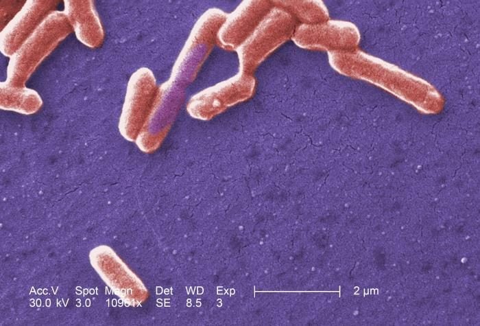 Qu'est-ce que l'Escherichia coli : symptômes, complications et traitement de l'infection causée par la bactérie 5 Colonia di Escherichia coli. Credit: Wikipedia