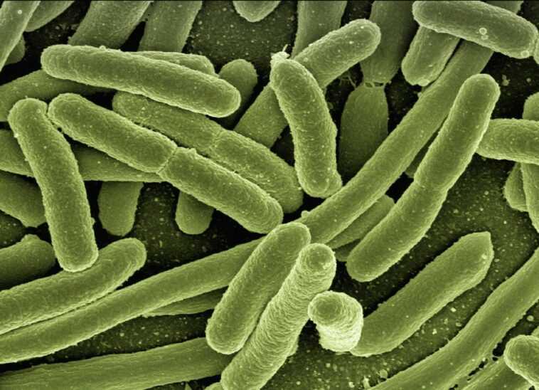 Qu'est-ce qu'Escherichia coli: symptômes, complications et traitement de l'infection causée par la bactérie 1 Qu'est Ce Qu'escherichia Coli: Symptômes, Complications Et Traitement De L'infection Causée