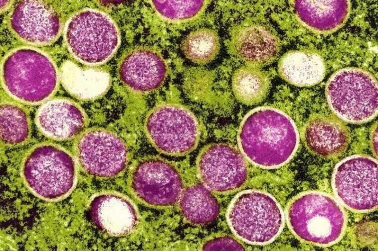 Ce mystérieux virus protège contre la variole du singe 1 Ce Mystérieux Virus Protège Contre La Variole Du Singe